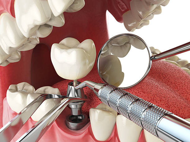 Best Cosmetic Emergency Dentistry in Silver Springs, FL